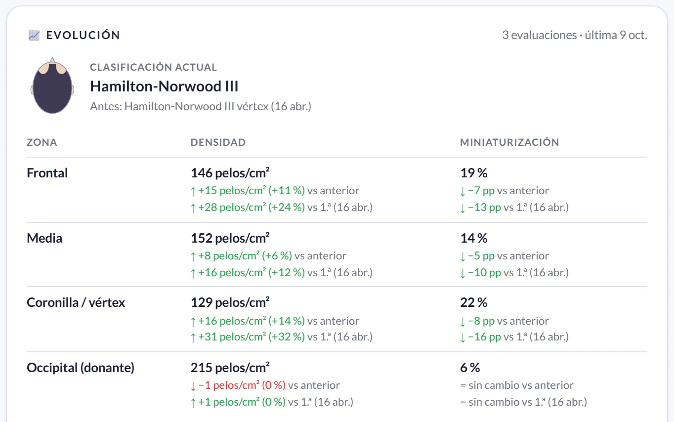 Tricoscopía en Sania: clasificación Hamilton-Norwood, densidad y miniaturización por zona comparadas con la evaluación anterior y con la primera, y el gráfico de densidad por zona